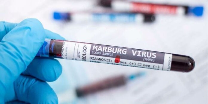 image Marburg Virus Outbreak