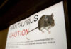 What to Know About Hantavirus and The Symptoms to Watch for hantavirus