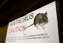What to Know About Hantavirus and The Symptoms to Watch for hantavirus