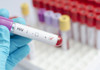 Kenya to Manufacture New Monthly HIV Prevention Pill